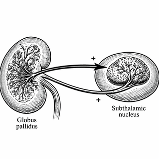 Researchers Found the Exact Neurons Causing Seizures in a Devastating Genetic Disease